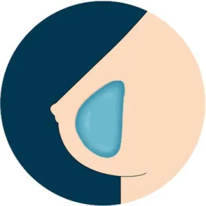 AF  Breast Option - Gel Breasts